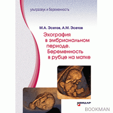 Эхография в эмбриональном периоде. Беременность в рубце на матке.