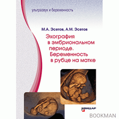 Эхография в эмбриональном периоде. Беременность в рубце на матке.