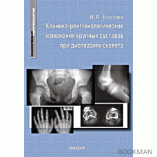 Клинико-рентгенологические изменения крупных суставов при дисплазиях скелета