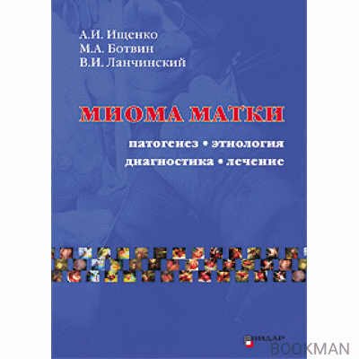 Миома матки. Этиология, патогенез, диагностика, лечение