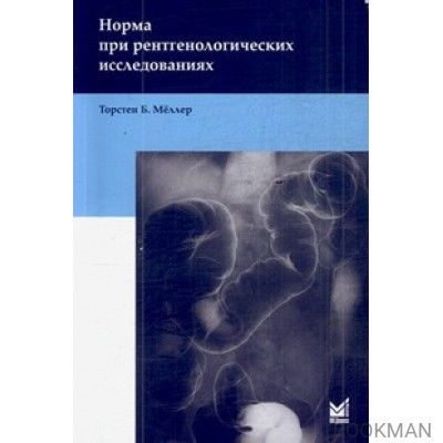 Норма при рентгенологических исследованиях.