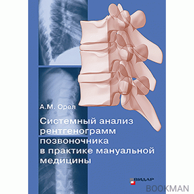 Системный анализ рентгенограмм позвоночника в практике мануальной медицины.