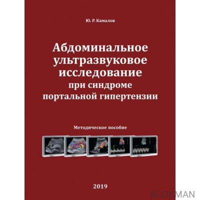 Абдоминальное ультразвуковое исследование при синдроме портальной гипертензии