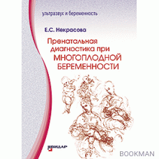 Пренатальная диагностика при многоплодной беременности.