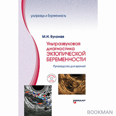 Ультразвуковая диагностика эктопической беременности. Руководство для врачей. +DVD-ROM