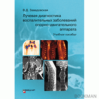 Лучевая диагностика воспалительных заболеваний опорно-двигательного аппарата.