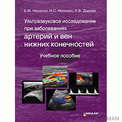 Ультразвуковое исследование при заболеваниях артерий и вен нижних конечностей.