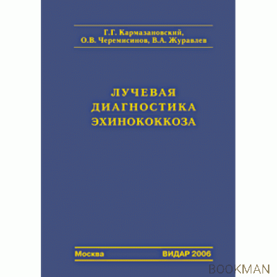 Лучевая диагностика эхинококкоза.