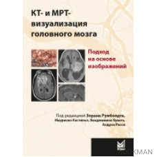 КТ и МРТ-визуализация головного мозга. Подход на основе изображений