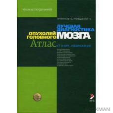 Лучевая диагностика опухолей головного мозга. Атлас КТ и МРТ-изображений.