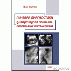 Лучевая диагностика дивертикулов чашечно-лоханочных систем почек